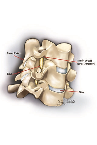 Boyun omurları arasındaki disklerin ve eklemlerin normal yapısı. İki omur arasındaki foramen adı verilen kanallardan sinirlerin çıkışı
