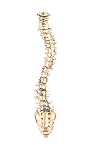 Scoliotic spine