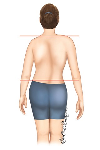 Asymmetry of the waist and shoulders