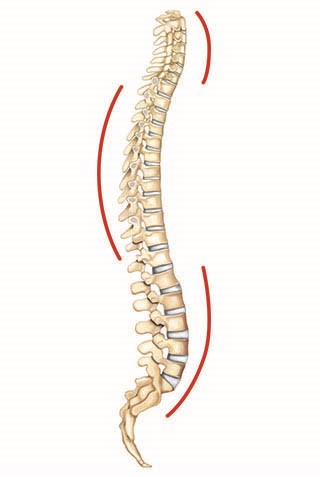 Loss of cervical lordosis is not a disease, but rather a symptom that may accompany other spinal diseases and conditions causing pain